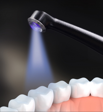 Фото: Стоматологическая светодиодная полимеризационная лампа Sunt smil lume с сенсорной подставкой-1 Стоматологическая светодиодная полимеризационная лампа Sunt smil lume с сенсорной подставкой-1